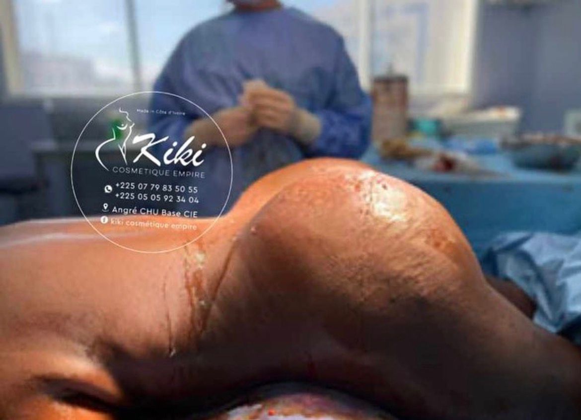 Chirurgie Esthétique