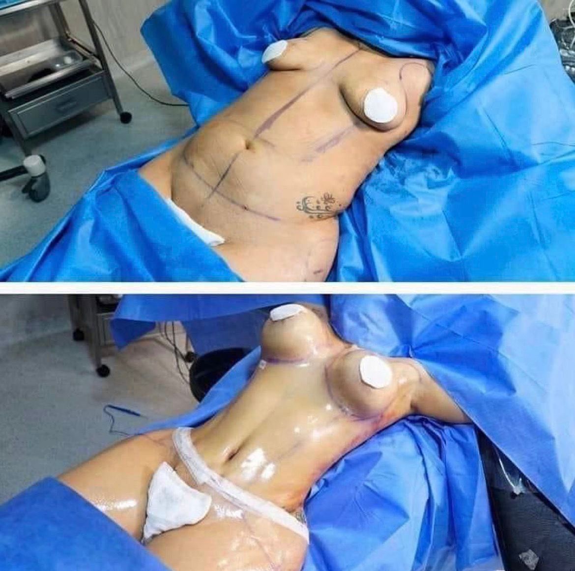 Chirurgie Esthétique